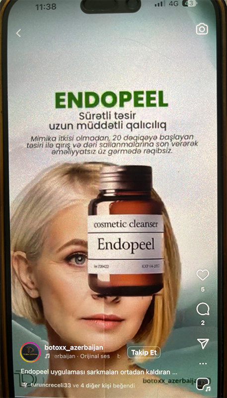 turk-derma-fake-endopeel-1